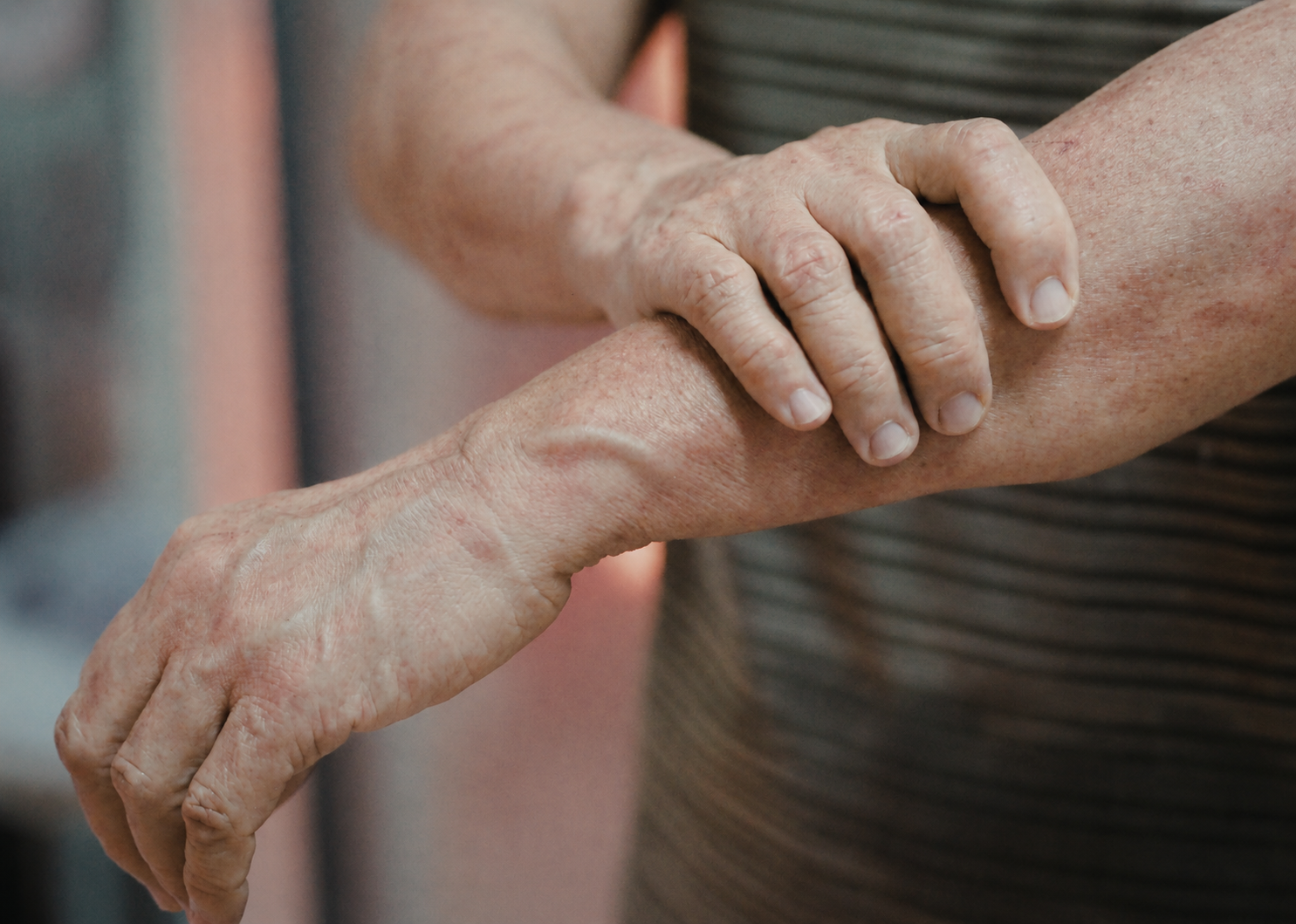 image showing skin to represent mottled skin before death