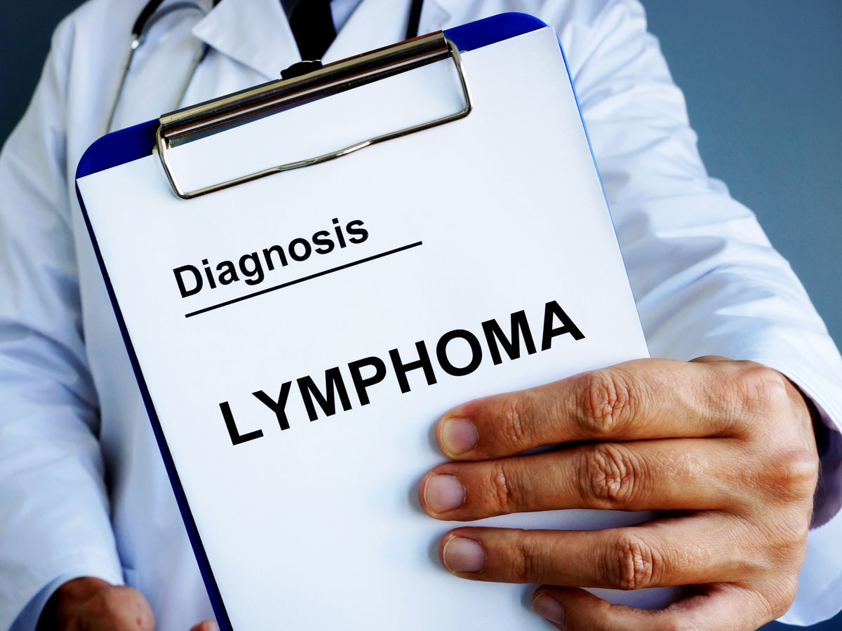 blog-lymphoma-fi-ss-1505226416