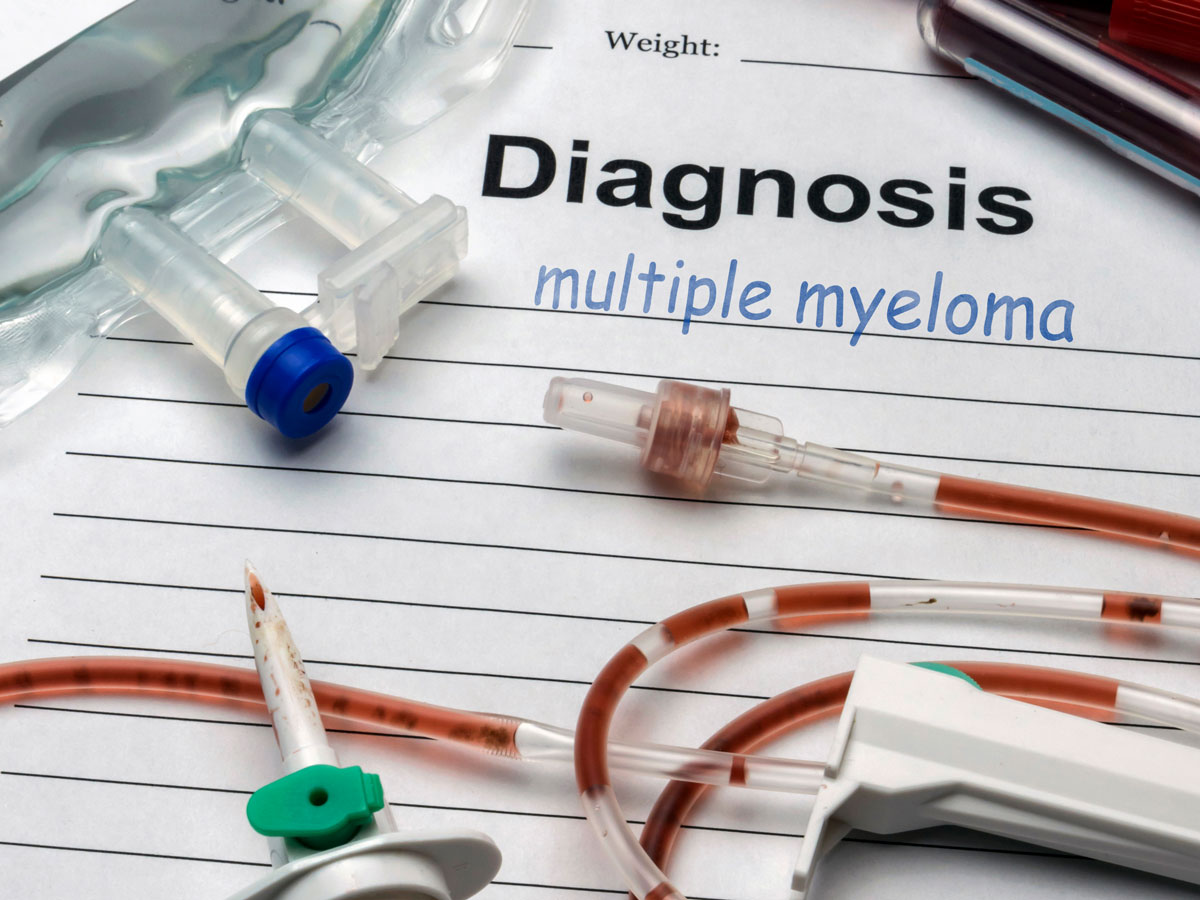 blog-multiple-myeloma-ss-768747157